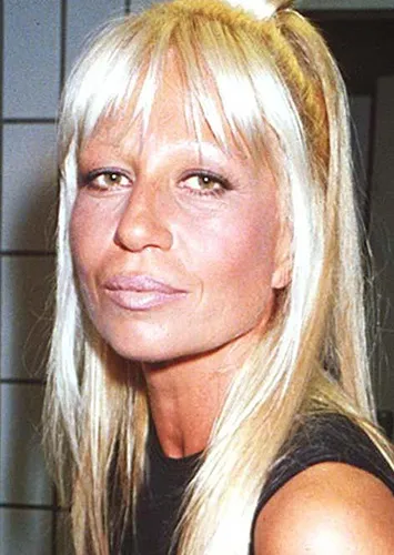 Самые знаменитые пластические операции звёзд: 20 фото знаменитостей до и после пластики Самые знаменитые пластические операции звёзд: 20 фото знаменитостей до и после пластики