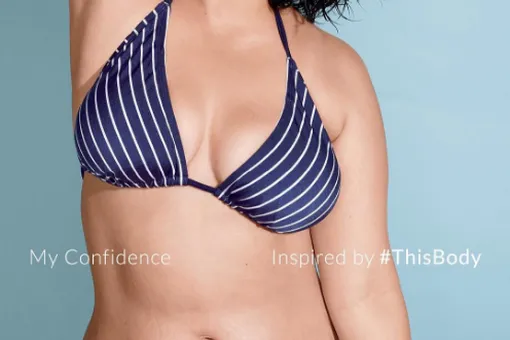 «Спасибо за уважение к моим растяжкам». В журнале не стали ретушировать фото модели