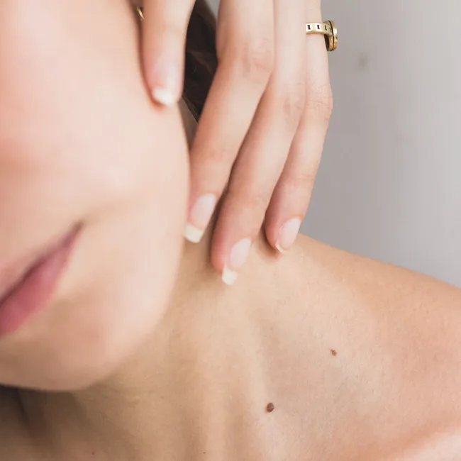 Салициловая кислота: почему самое популярное средство от прыщей не так полезно, как мы думали?