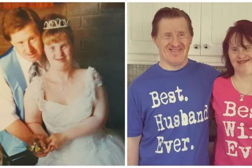 Пара с синдромом Дауна отпраздновала 22 года семейной жизни Пара с синдромом Дауна отпраздновала 22 года семейной жизни