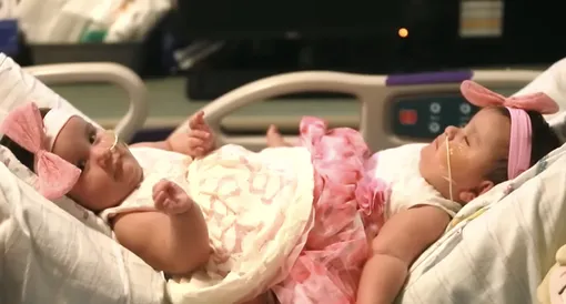 Скарлетт и Химена до операции