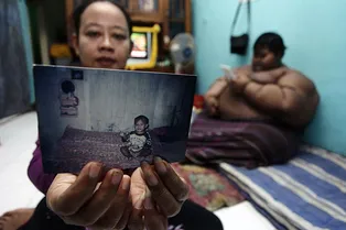 Самый толстый подросток в мире похудел на 100 килограммов и смог пойти в кино