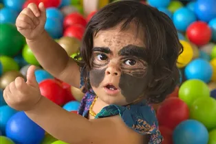 Мама девочки с «пятном Бэтмена» показала, как идет удаление невуса у дочери