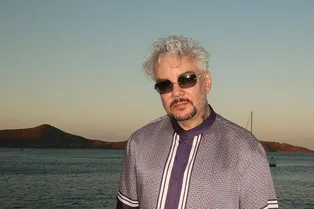 Филипп Киркоров показал незаживающую рану после ожога на сцене Филипп Киркоров показал незаживающую рану после ожога на сцене