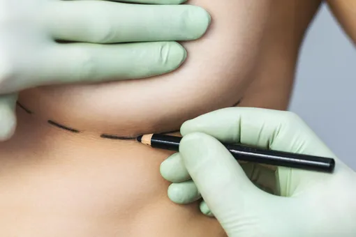 14-летняя девочка умерла после операции по увеличению груди, которую скрыла от родителей 14-летняя девочка умерла после операции по увеличению груди, которую скрыла от родителей