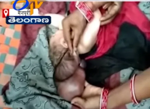 ребенок с тремя головами ребенок с тремя головами