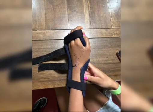 Дамиана пытается разрабатывать левую руку Дамиана пытается разрабатывать левую руку