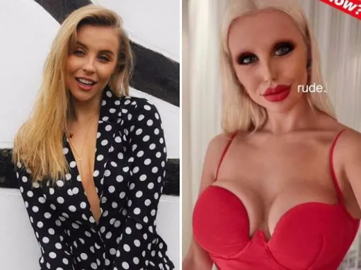 Чесси до и после трансформации Чесси до и после трансформации