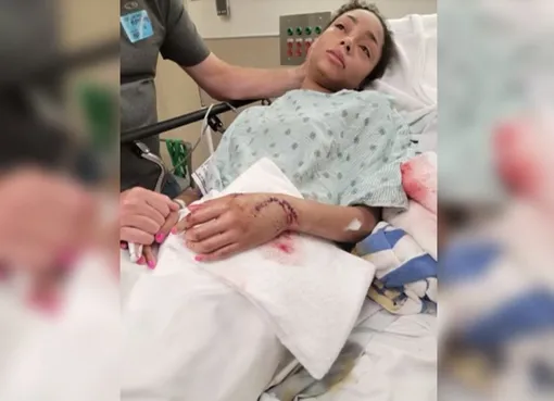 Дамиана сразу после госпитализации Дамиана сразу после госпитализации