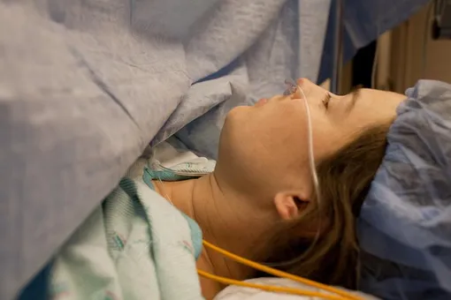 кесарево кесарево