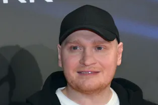 Победивший рак Сергей Сафронов сделал пересадку волос — фото