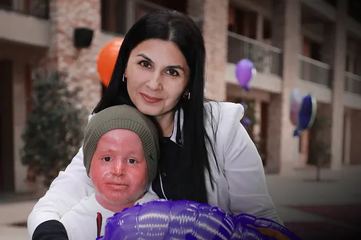 «Я бы не хотела быть сильной»: как мама мальчика-«рыбки» смогла победить отчаяние и поддержать сына