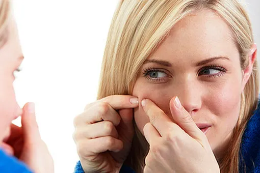 10 причин появления прыщей, о которых вы и не догадывались 10 причин появления прыщей, о которых вы и не догадывались