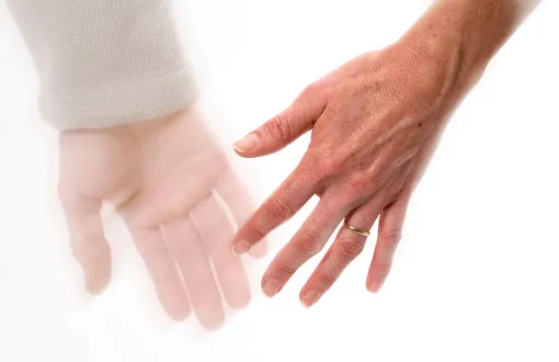 Деменция и брак Деменция и брак