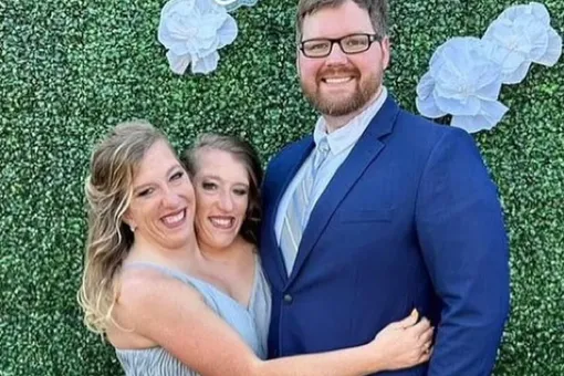 Сиамские близняшки Эбби и Бриттани Хенсел стали матерями: первые кадры сестёр с детским автокреслом Сиамские близняшки Эбби и Бриттани Хенсел стали матерями: первые кадры сестёр с детским автокреслом