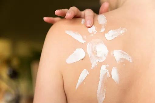 9 действенных советов по борьбе с солнечными ожогами