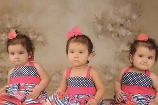 «Говорили, не будут ходить — они танцуют»: как выглядят сиамские близнецы, разделённые в 2016 году