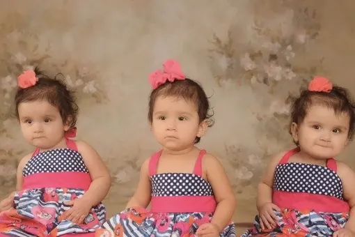 «Говорили, не будут ходить — они танцуют»: как выглядят сиамские близнецы, разделённые в 2016 году