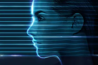 Держать лицо. Что нужно знать о нитях для лифтинга