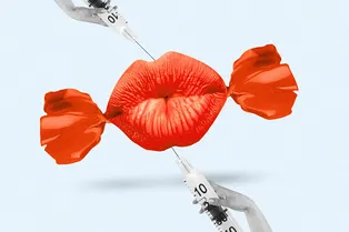 Все же захотела больше: как бьюти-редактор решилась на повторное увеличение губ