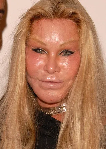 Самые знаменитые пластические операции звёзд: 20 фото знаменитостей до и после пластики Самые знаменитые пластические операции звёзд: 20 фото знаменитостей до и после пластики