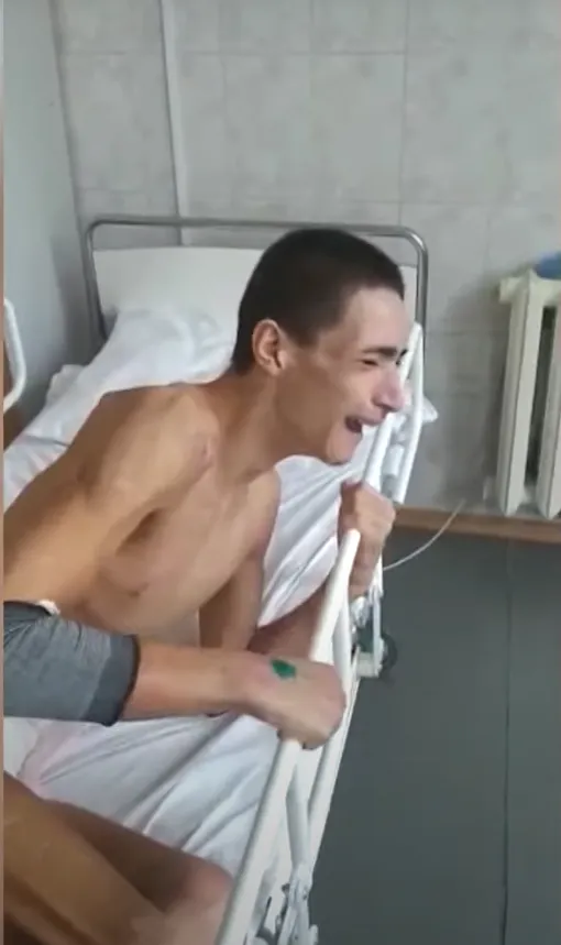 больной с апендицитом