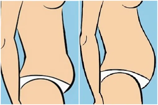 5 видов женских животиков и простые способы сделать их плоскими: сенсация! 5 видов женских животиков и простые способы сделать их плоскими: сенсация!