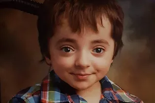 Из-за редкого заболевания мальчик может сломать кости, просто улыбнувшись маме