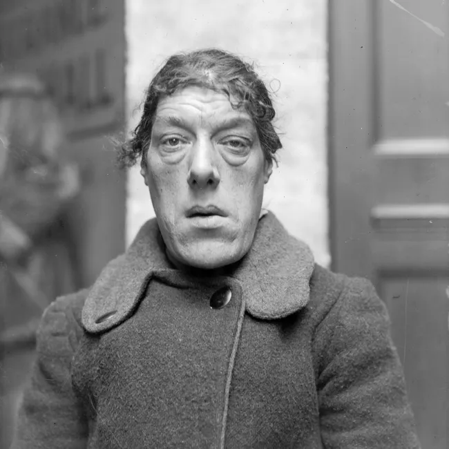 История Мэри Энн Беван, носившей титул самой уродливой женщины в мире