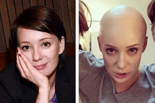 Чулпан Хаматова побрилась налысо из-за роли в спектакле Чулпан Хаматова побрилась налысо из-за роли в спектакле