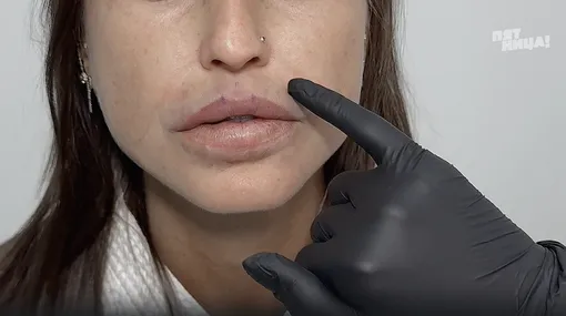 «Вазелиновые губы» героини программы «Вазелиновые губы» героини программы