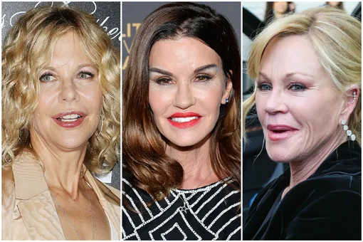 Без тормозов: звезды, которые никак не могут остановиться с пластикой