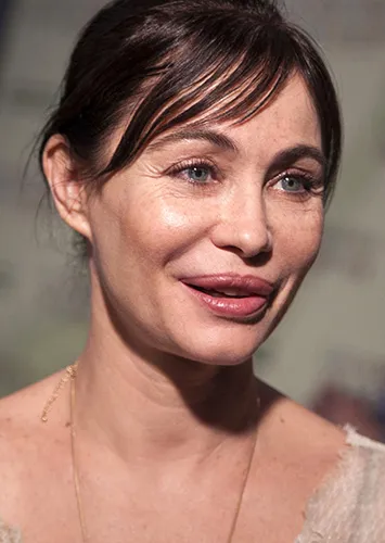 Самые знаменитые пластические операции звёзд: 20 фото знаменитостей до и после пластики Самые знаменитые пластические операции звёзд: 20 фото знаменитостей до и после пластики