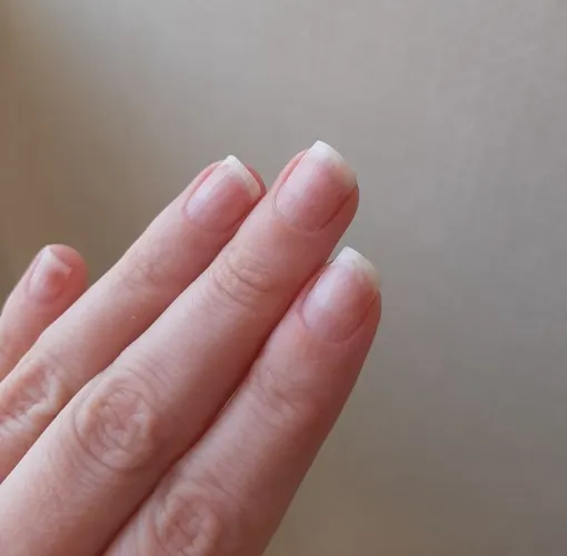 как отрастить ногти после гель-лака