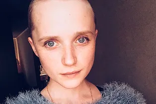 Нижегородская модель, пережившая трепанацию черепа, стала музой бренда Gucci Нижегородская модель, пережившая трепанацию черепа, стала музой бренда Gucci