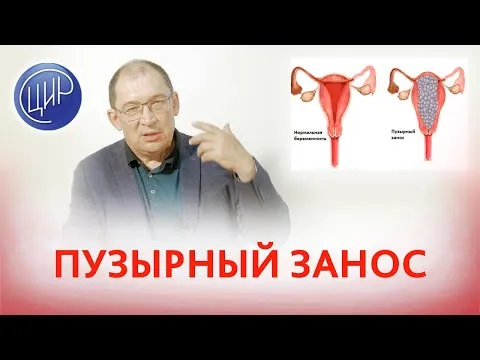 Нажми и смотри