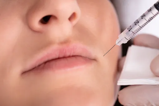 «Мне изуродовали лицо»: россиянку, у которой посинели и распухли губы после процедуры, клиника обвинила в вымогательстве «Мне изуродовали лицо»: россиянку, у которой посинели и распухли губы после процедуры, клиника обвинила в вымогательстве