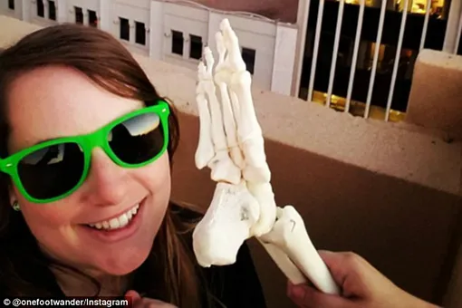 Девушке ампутировали ногу, но она не унывает — возит ее по свету и ведет Инстаграм* Девушке ампутировали ногу, но она не унывает — возит ее по свету и ведет Инстаграм*