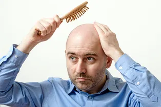 Мужское облысение: всё решаемо, если знать как