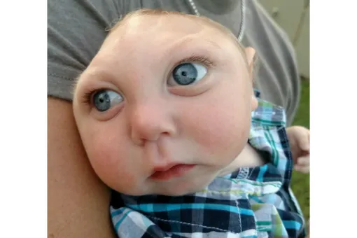 Трогательная история Джексона Силача. Ему пророчили сутки жизни, он перешагнул за год Трогательная история Джексона Силача. Ему пророчили сутки жизни, он перешагнул за год