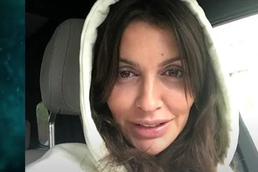 Алисе Аршавиной почти восстановили нос, но он начал разрушаться