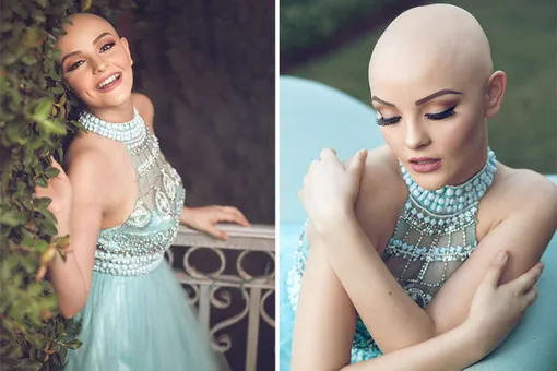 «Рак не помешает мне быть принцессой» «Рак не помешает мне быть принцессой»