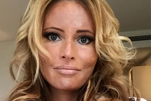 Не узнать: Дана Борисова сделала пластику Не узнать: Дана Борисова сделала пластику