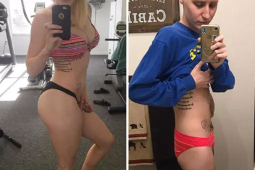 «Вот что со мной сделал рак» Фитнес-модель выложила несколько впечатляющих фотографий «Вот что со мной сделал рак» Фитнес-модель выложила несколько впечатляющих фотографий