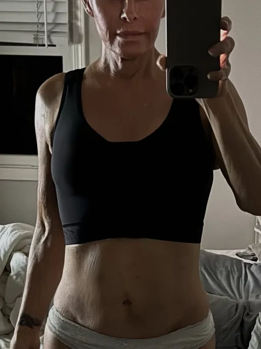 «В четверг мне сделали мастэктомию с реконструкцией. Как прошли ваши выходные?» «В четверг мне сделали мастэктомию с реконструкцией. Как прошли ваши выходные?»